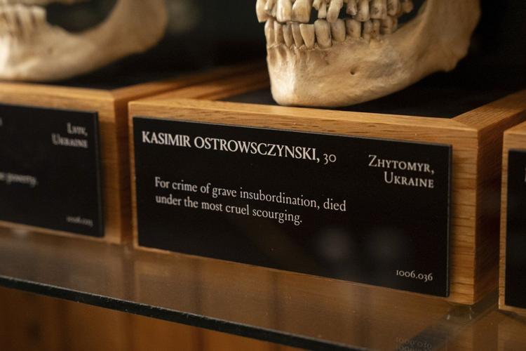Medical museum in Philadelphia overhauls policies on human remains to meet modern ethical standards