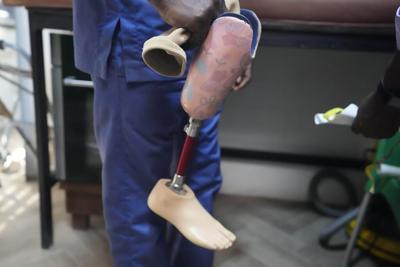 Nigerian group provides hundreds of prosthetic limbs to amputee children thanks to crowdfunding