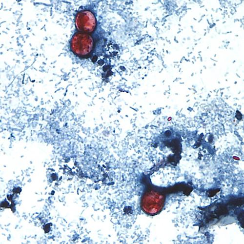 Taylor Farms recalls lettuce shipped to 27 states over cyclospora risk