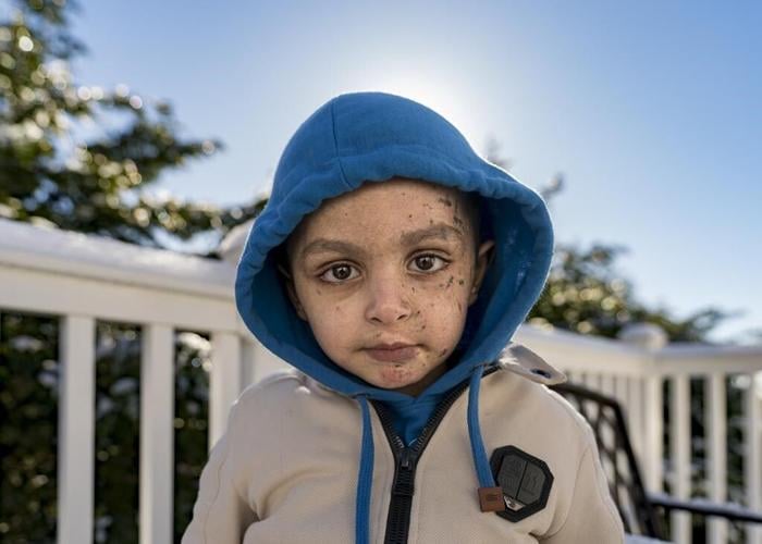 A 4-year-old Gaza boy lost his arm – and his family. Half a world away, he’s getting a second chance