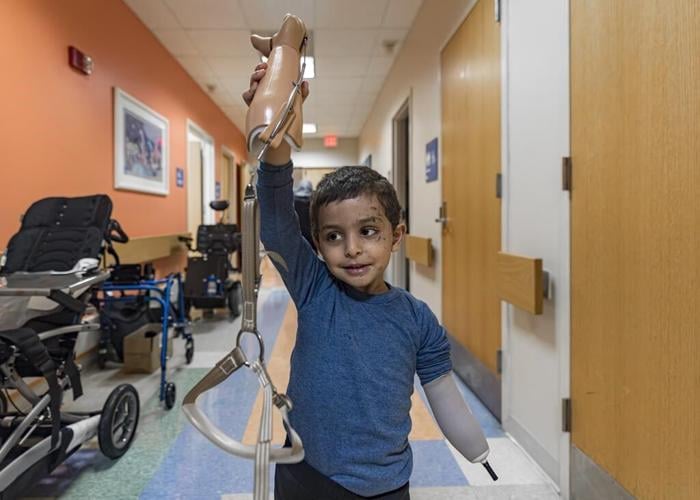 A 4-year-old Gaza boy lost his arm 鈥� and his family. Half a world away, he鈥檚 getting a second chance