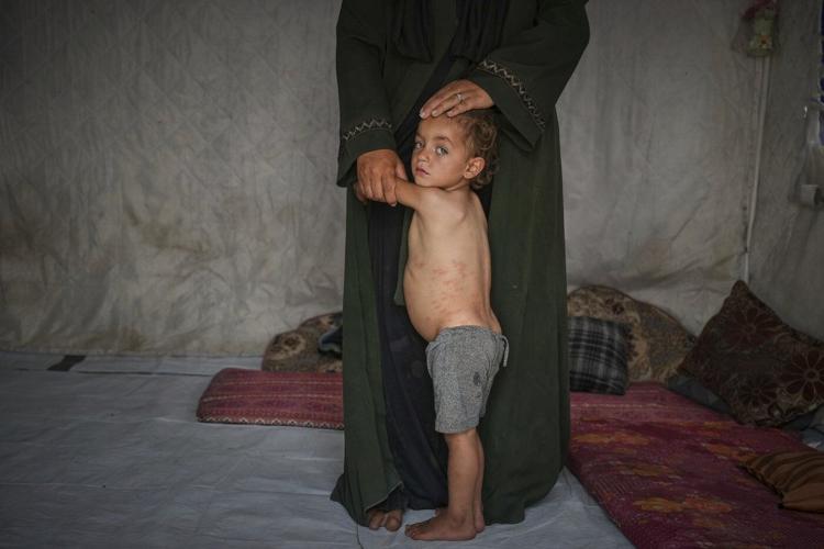 AP PHOTOS: Scenes from Gaza