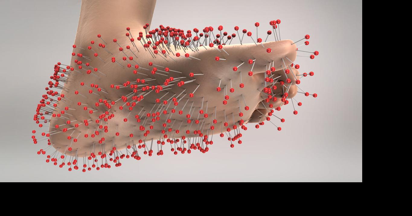 Peripheral neuropathy: Know the signs | News