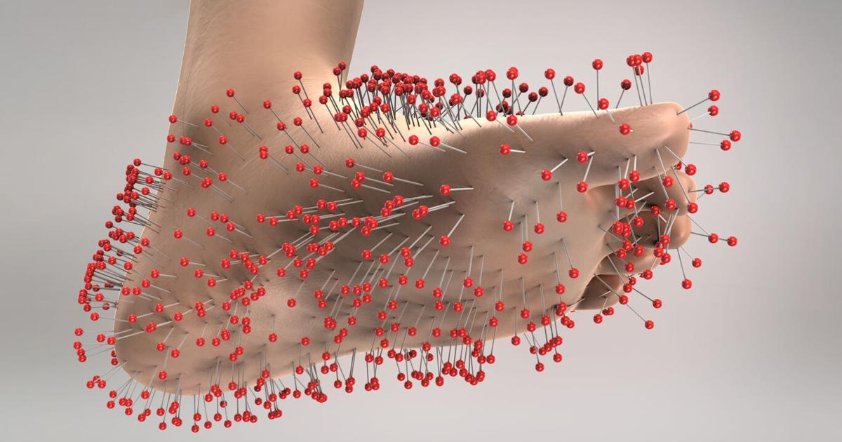 Peripheral neuropathy: Know the signs | News Peripheral neuropathy: Know the signs | News