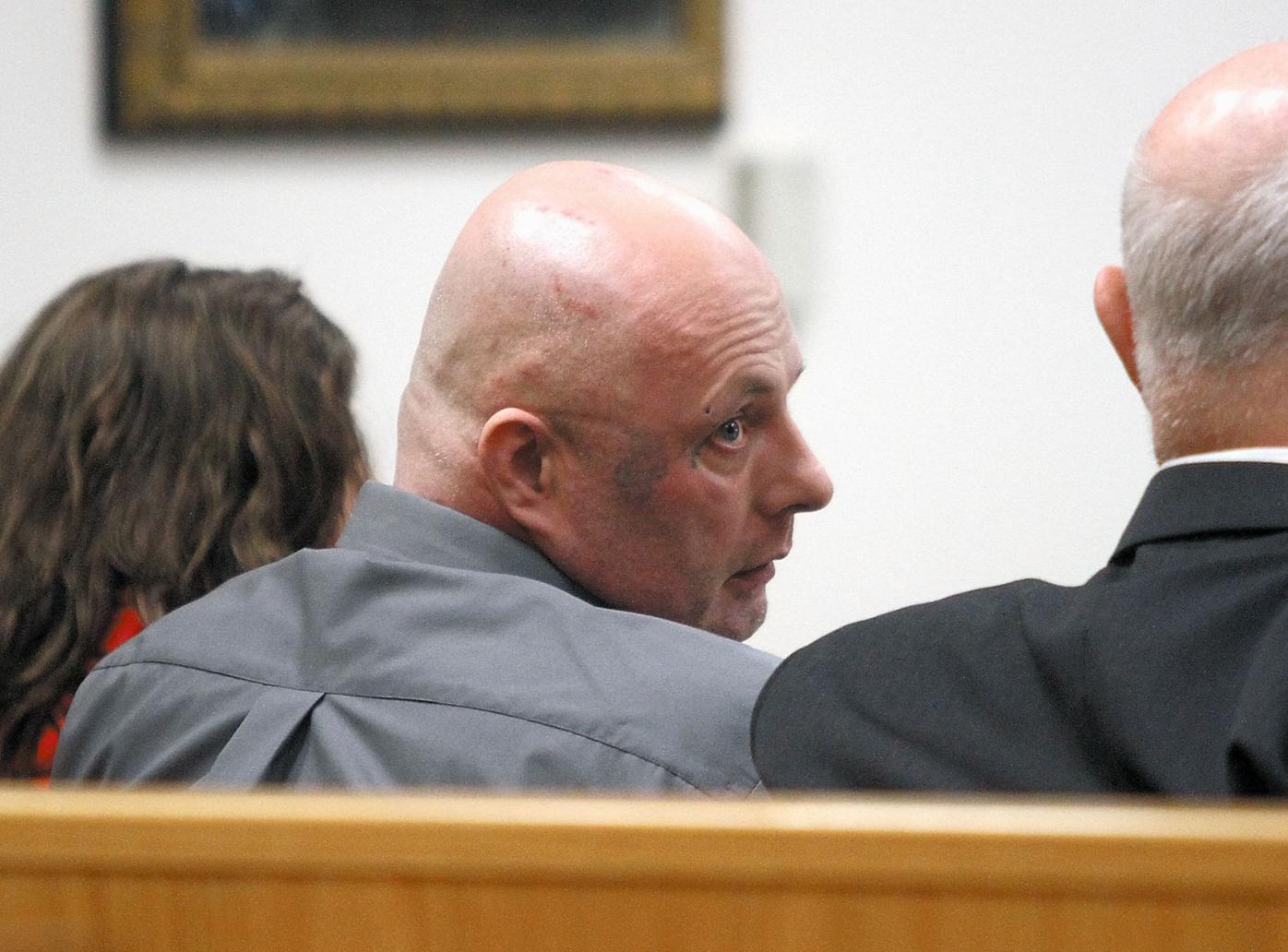 Investigator testifies Harmon had burns on arm legs hands News