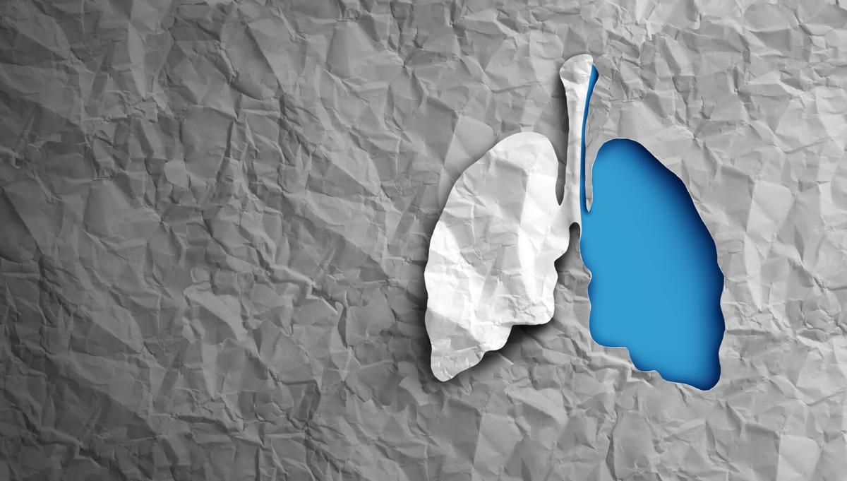 premium-health-lungs-20210203