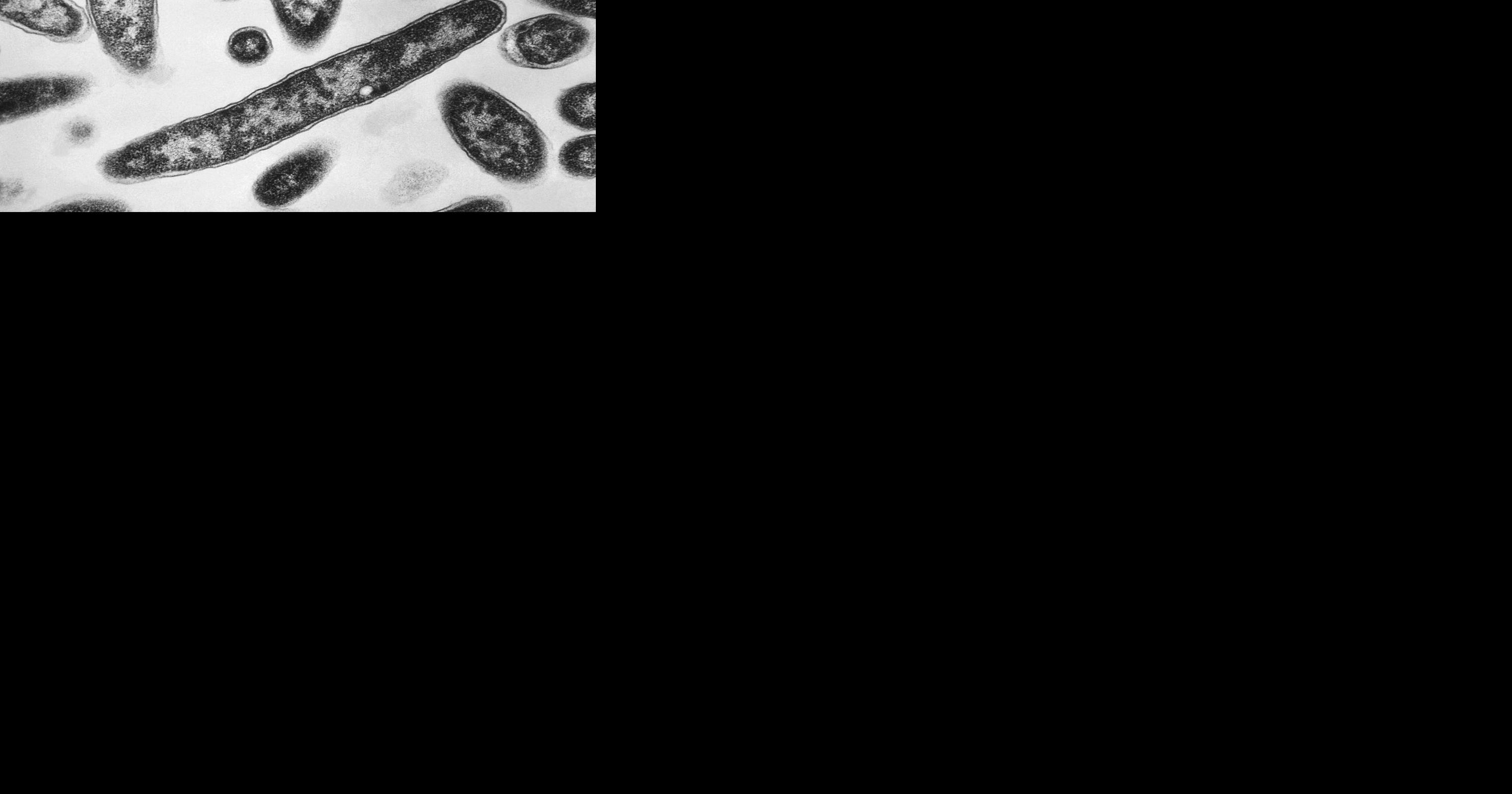 Second death reported in Legionnaires’ disease outbreak in New York City