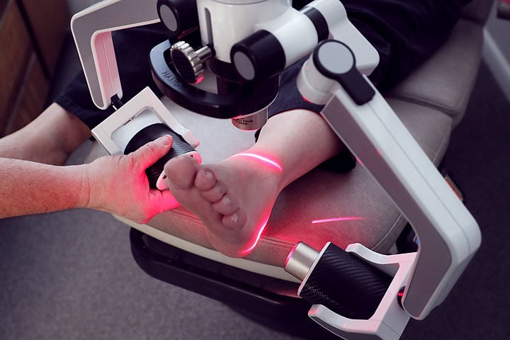 laser treatment for foot pain