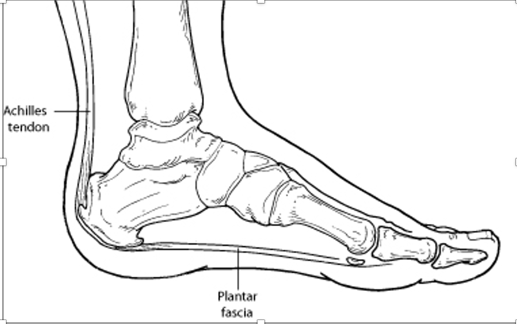 Exercises for plantar fasciitis (heel pain) - Footlogics