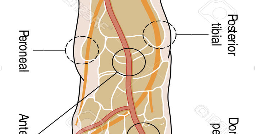 No pulses in your feet can be a warning of peripheral artery disease