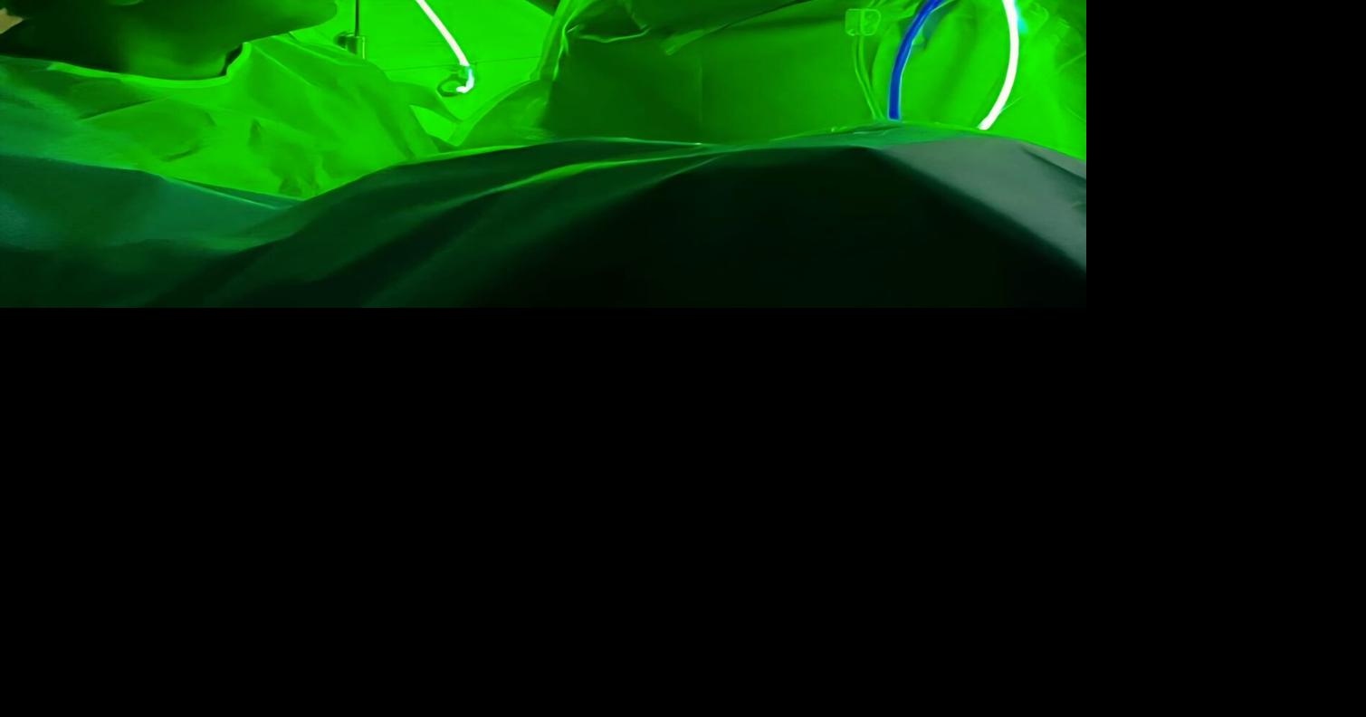Dr. Greggory Pinto performs The Bahamas' first GreenLight photovaporization of prostates