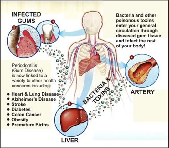 Healthy gums, healthier life: The dangerous link between gum disease ...