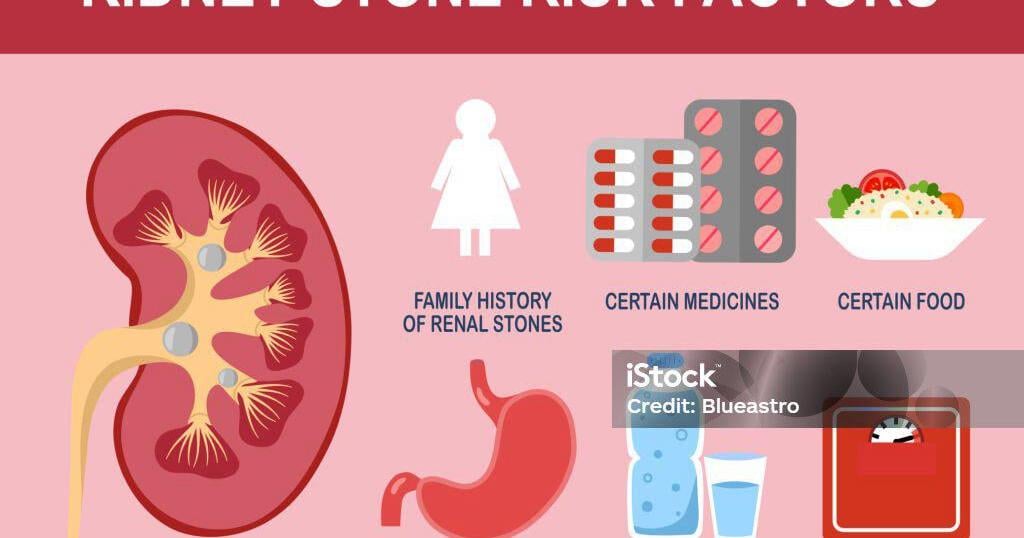 Salt, seafood, and stones: Can a Caribbean diet increase risk?