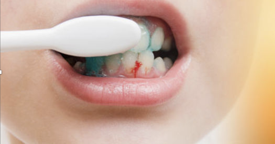 Vitamin D deficiency and its impact on dental health
