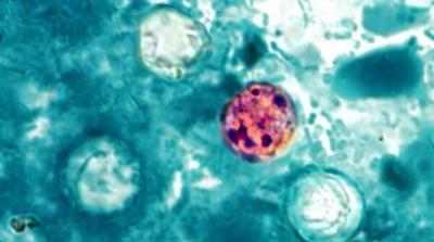 Cyclospora.jpg