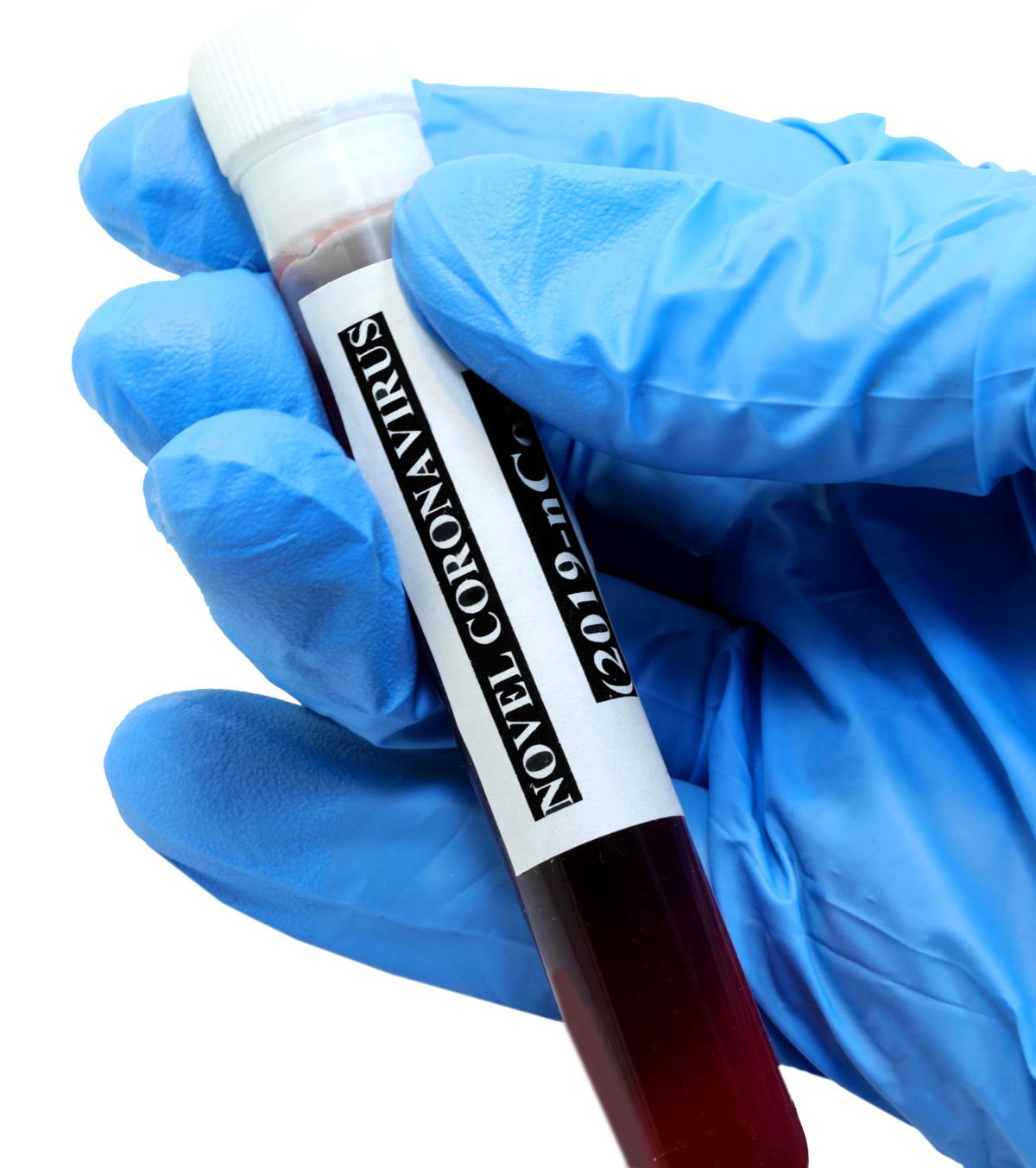 test tube for blood tests of Coronavirus on white background