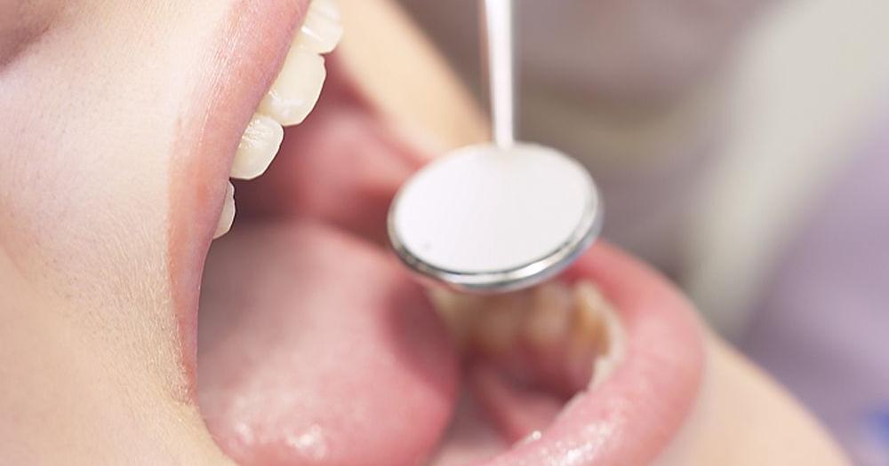 Dental plan fails people with developmental disabilities