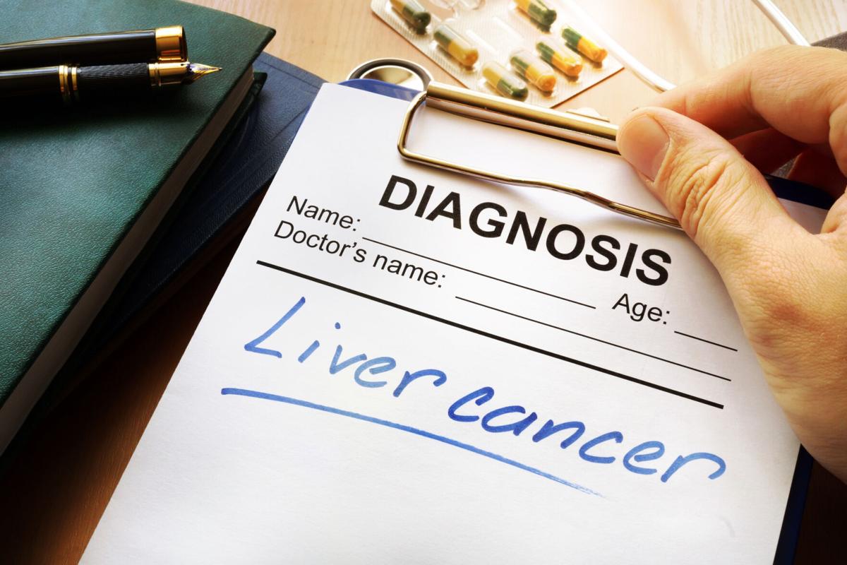 mayo-liver-20201105