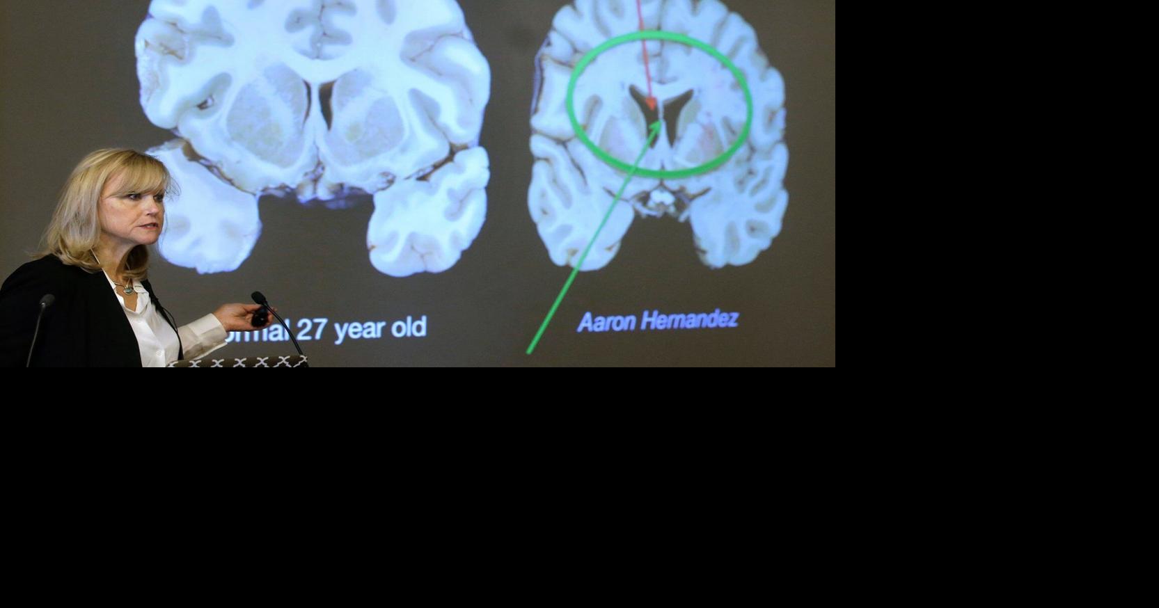 Here's what to know about CTE, the brain disease the NYC shooter blamed ...