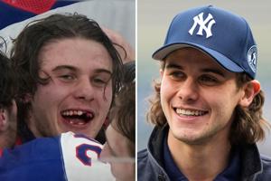 Olympic hero Jack Hughes has new chiclets as NHL dentists get a moment in the spotlight