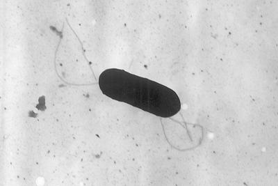 What to know about food poisoning illnesses caused by listeria