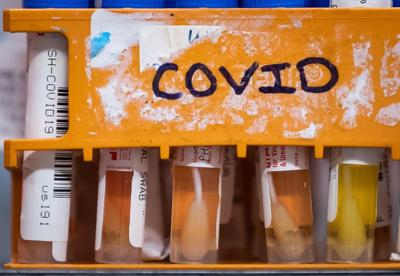Think you have a 'summer cold'? There's a good chance it's COVID-19, doctors say