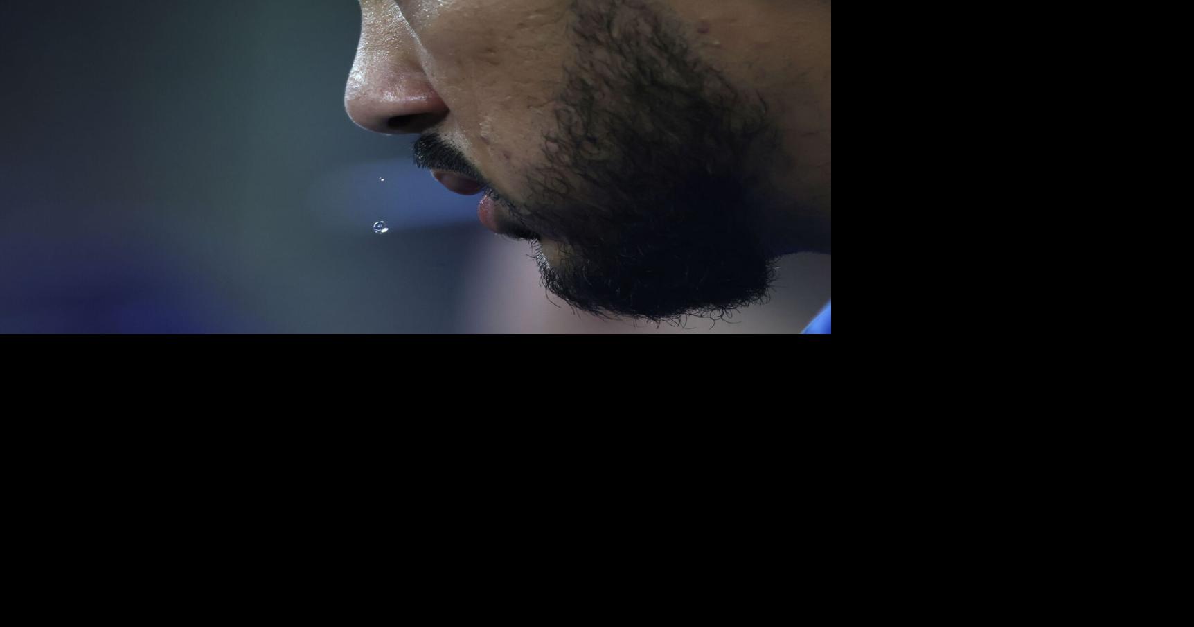 Blue Jays’ Santander to have surgery, miss up to six months