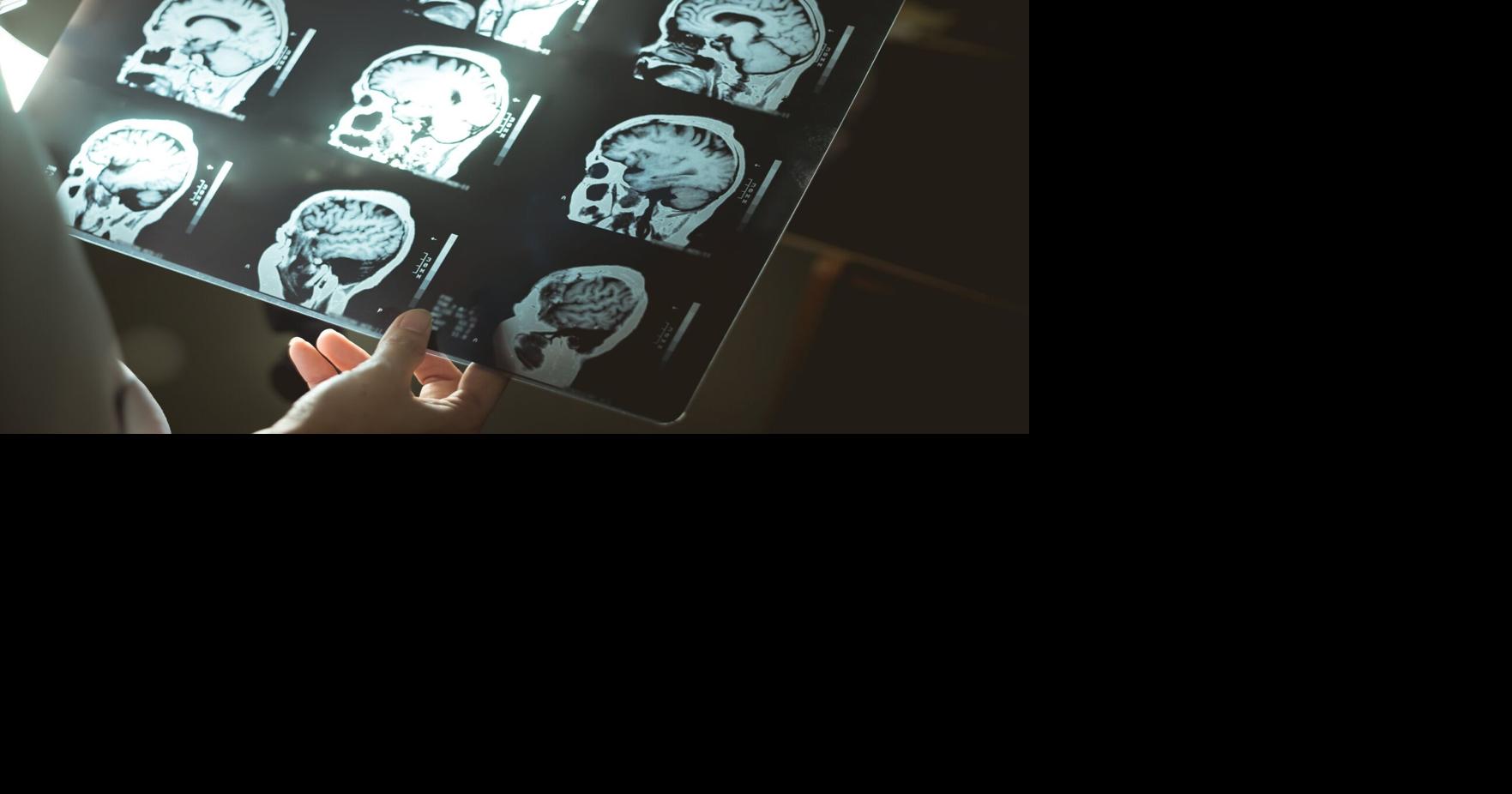 9 surprising habit changes that could prevent or delay dementia, according to Toronto experts
