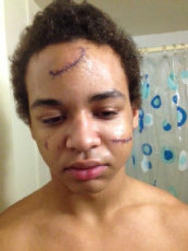 Wired glass linked to ‘horrible injuries’