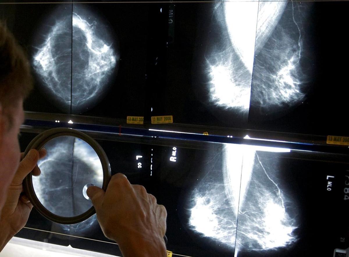 Was Canada right to change its breast screening guidelines? Yes