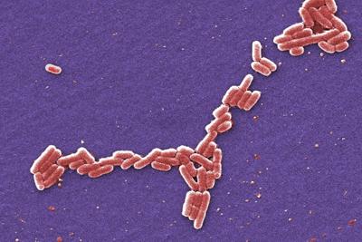 Some facts about the Shiga toxin-producing E. coli outbreak at Calgary daycares
