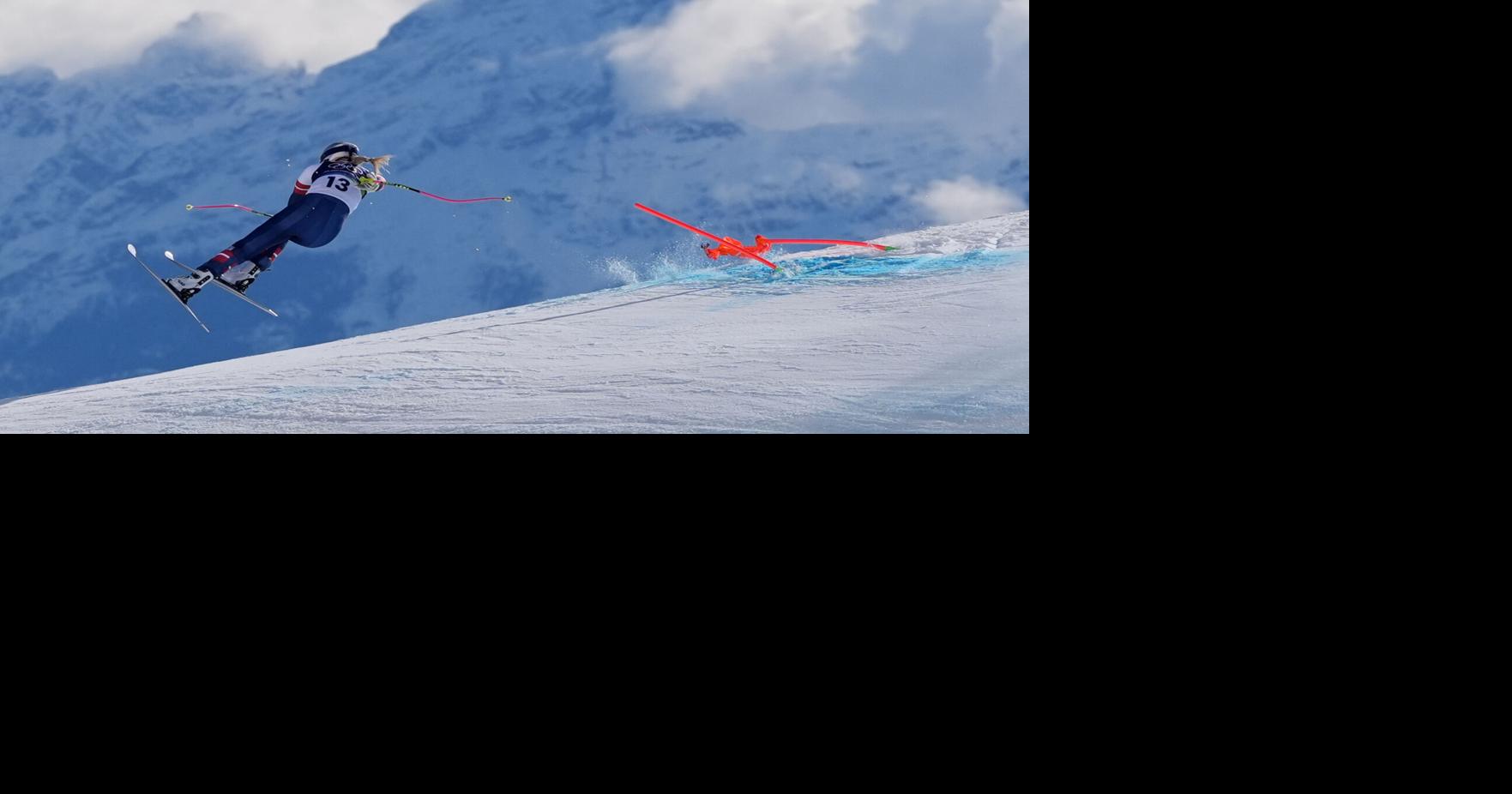 Lindsey Vonn says she had a &lsquo;successful&rsquo; 3rd surgery on broken leg following crash at the Olympics