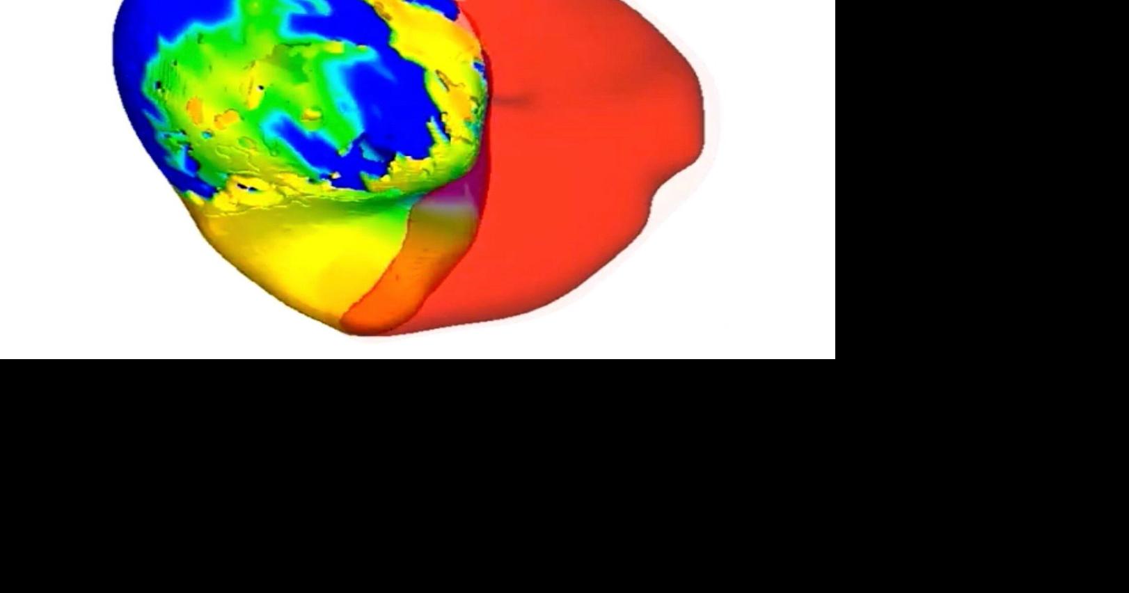 To fix a patient's irregular heartbeat, doctors first tested its digital 'twin'