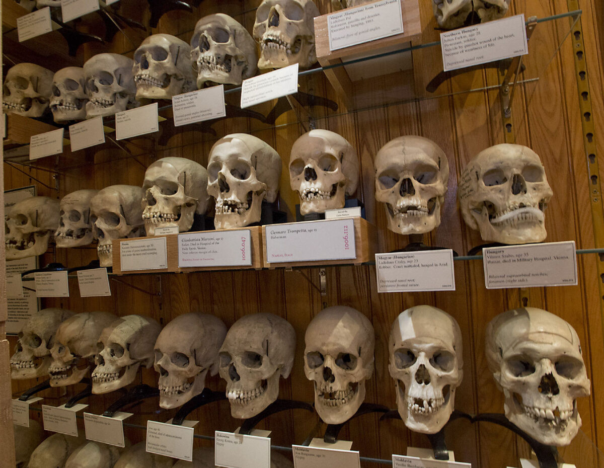 Weird Travel: Philadelphia medical museum is a ghoulish treat