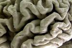 Study shows a blood test can help identify healthy people at high risk for Alzheimer's disease