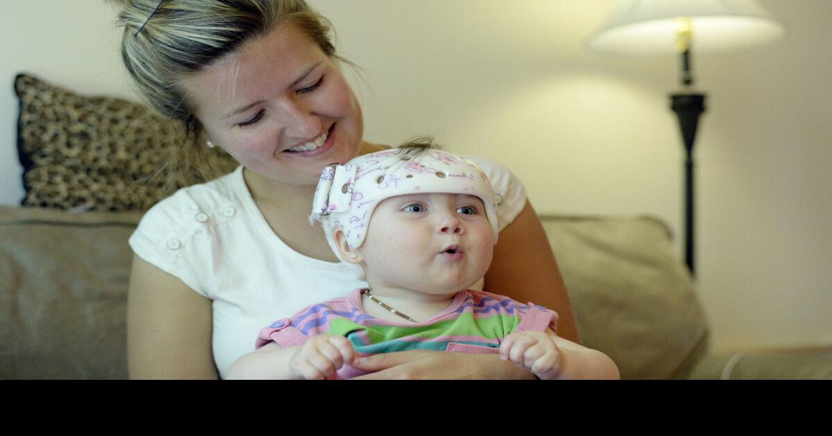 Flat spots on babies’ heads common result of sleeping on back, study finds