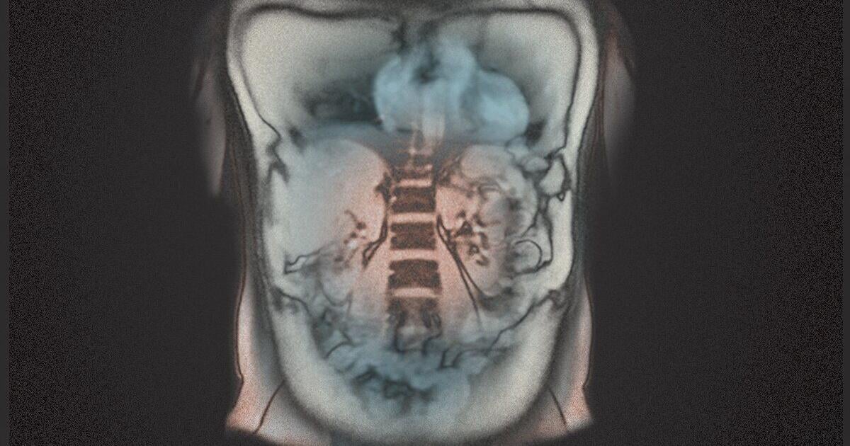 How a private MRI left me with more questions than answers