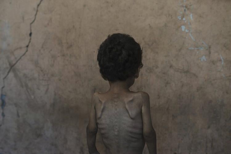 Israel's leader claims no one in Gaza is starving. Data and witnesses disagree