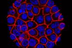 Experimental pill promises new hope for deadly pancreatic cancer