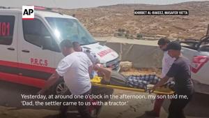 Palestinian amputee beaten with pipe by Israeli settler in the West Bank