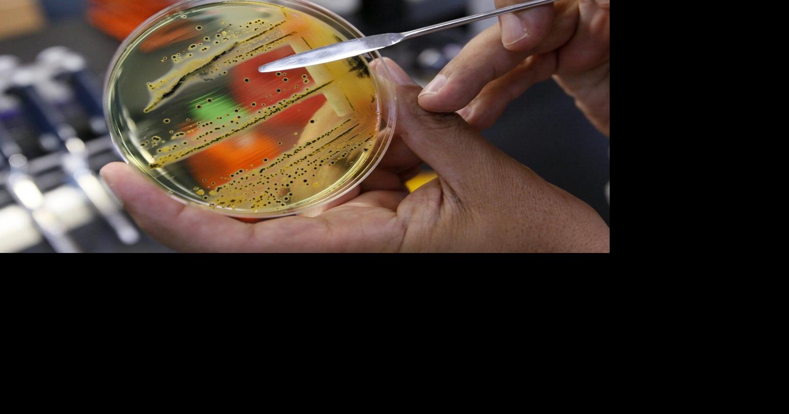 Hamilton restaurant temporarily closed due to salmonella outbreak: public health