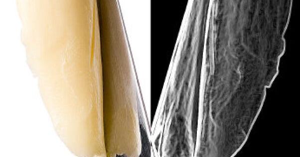 Butter vs. margarine: Food fight