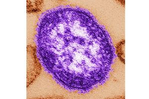 Pennsylvania officials report state's 3rd death involving measles