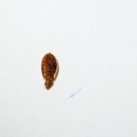 NYT opinion columnists writing about Twitter slights: It didn't start with  the bedbugs.