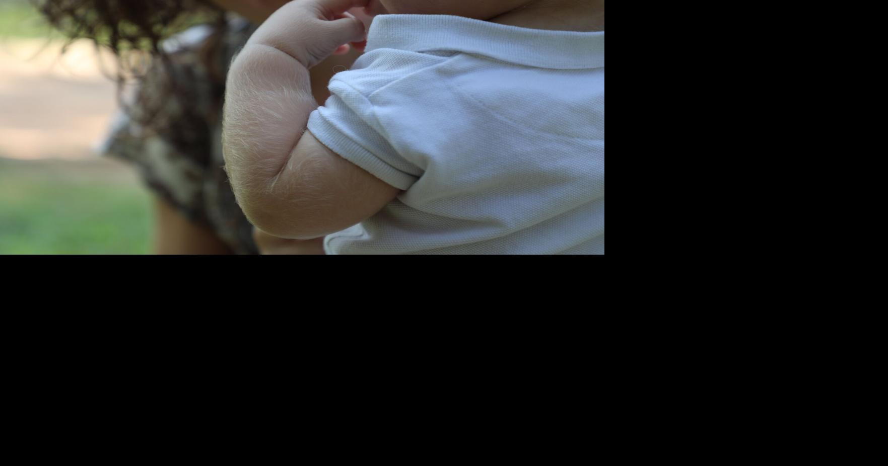 Hair Loss Drug Linked to Excess Body Hair in Infants - News Directory 3