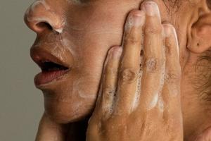 Adult acne is real, but there are ways to treat it. Here's what to know