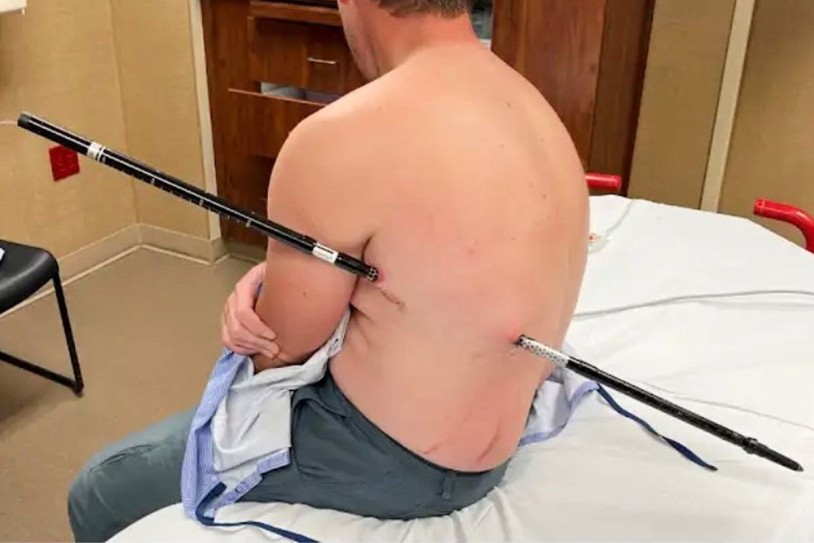 Montana nurse David Cifaldi self-rescues after being impaled by trekking pole during hike on Granite Peak