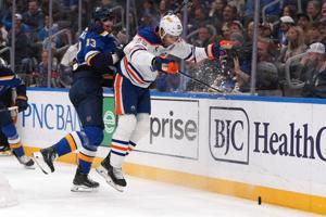 Blues' Snuggerud is having wrist surgery and Toropchenko out after burning legs in a home accident