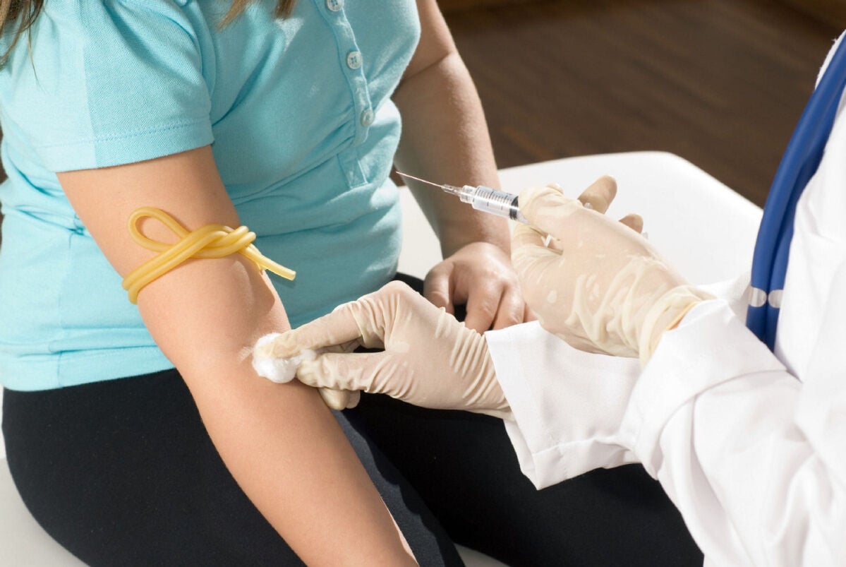 Fasting before cholesterol tests may not be necessary