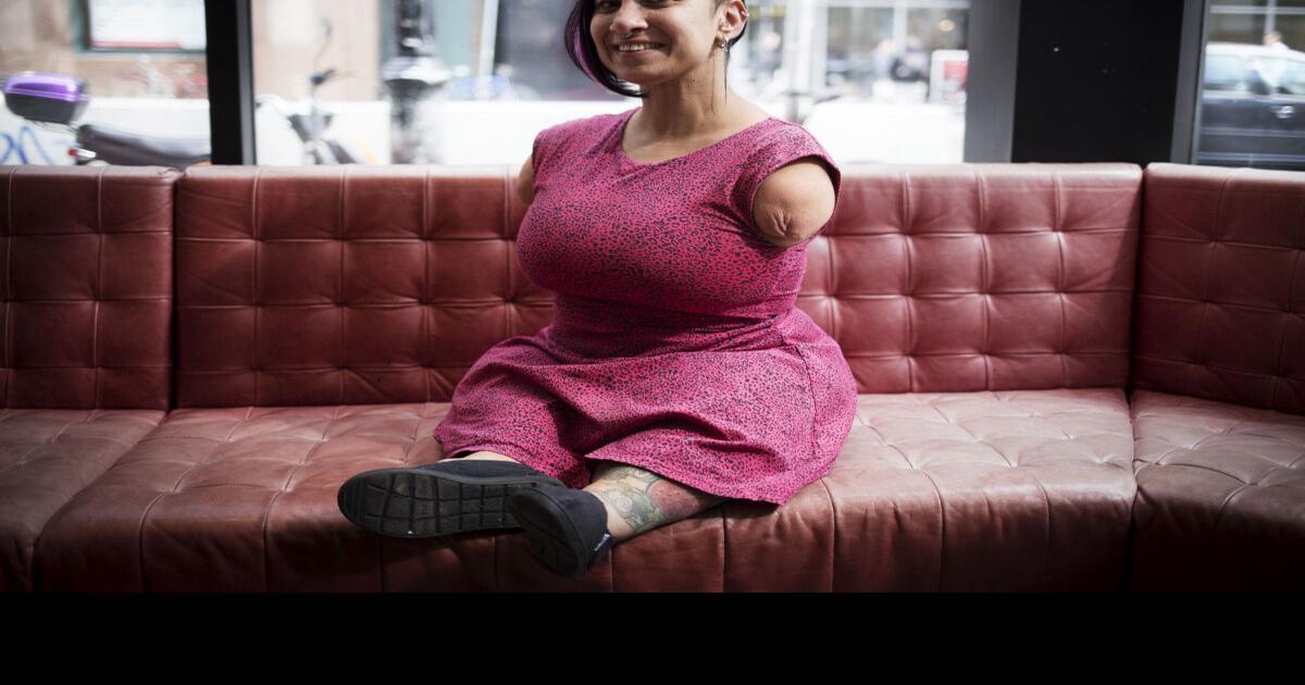 Talli Osborne, born without full arms or legs, inspires punk rockers